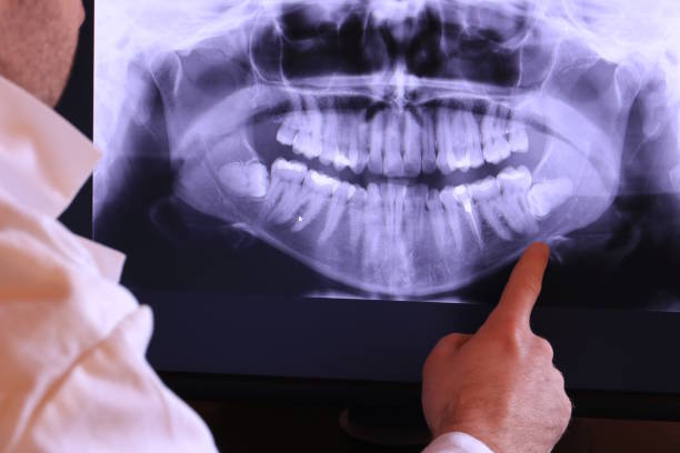 Urgent Tooth Repair in HI